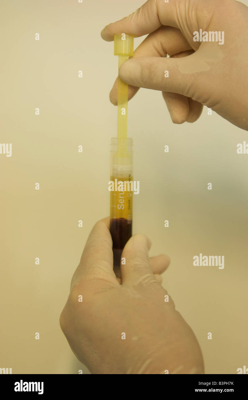 La main dans un gant stérile séparant du sérum provenant d'un tube de sang dans un laboratoire Banque D'Images