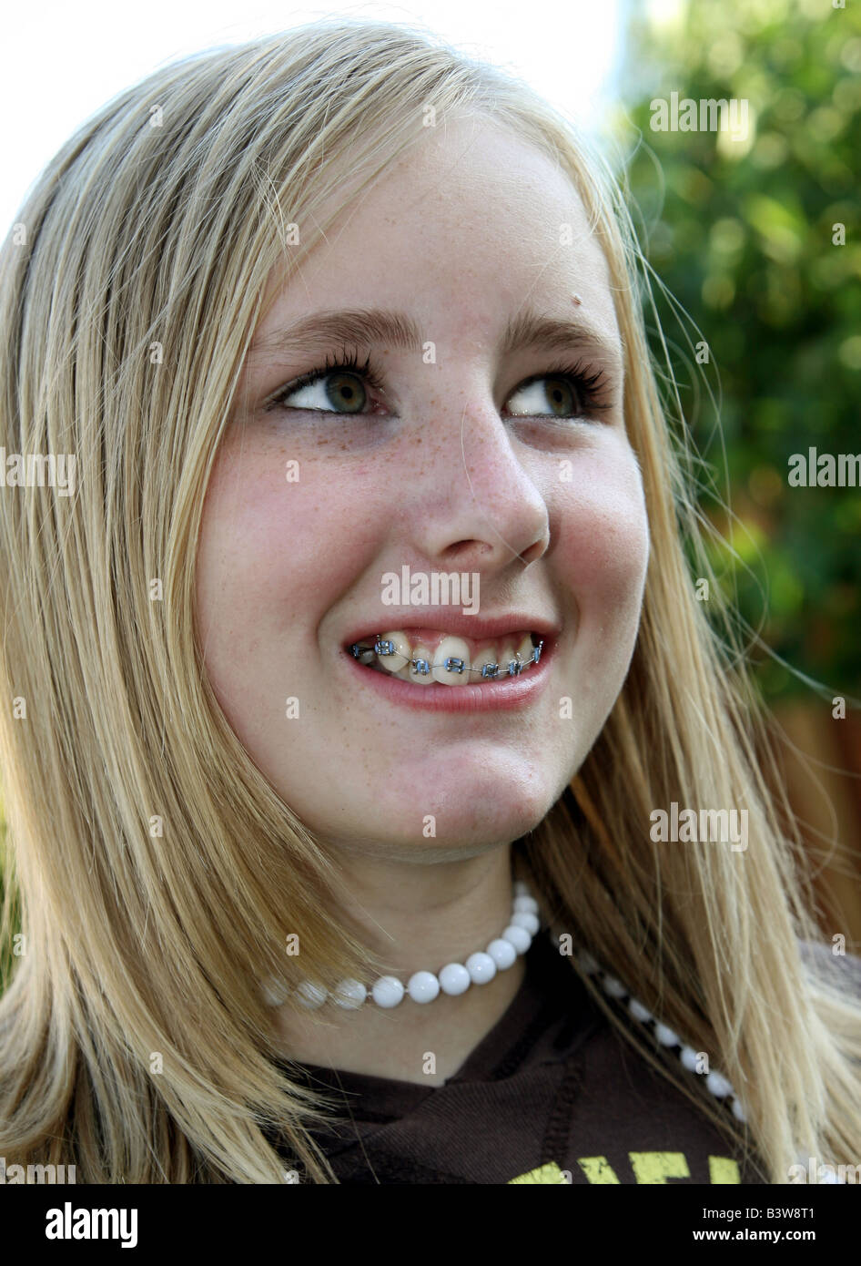 Jolie fille blonde de 12 ans avec sa nouvelle prothèse, 2006 Banque D'Images