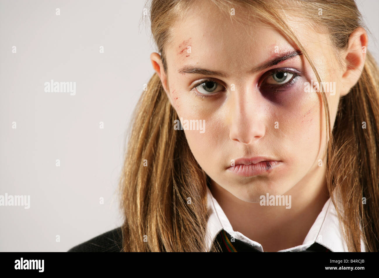 "Fille de l'école avec un oeil au beurre noir et des blessures au visage posé par Charley modèle effets spéciaux constituent par Rebecca Forshaw" Banque D'Images