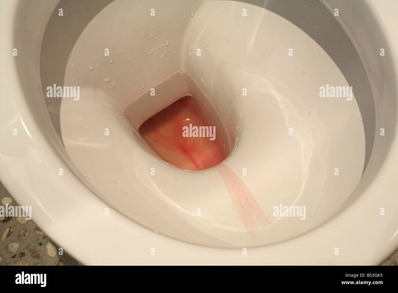 Toilettes avec du sang dans l'urine indiquant une infection urinaire  prostate élargie ou des reins Photo Stock - Alamy