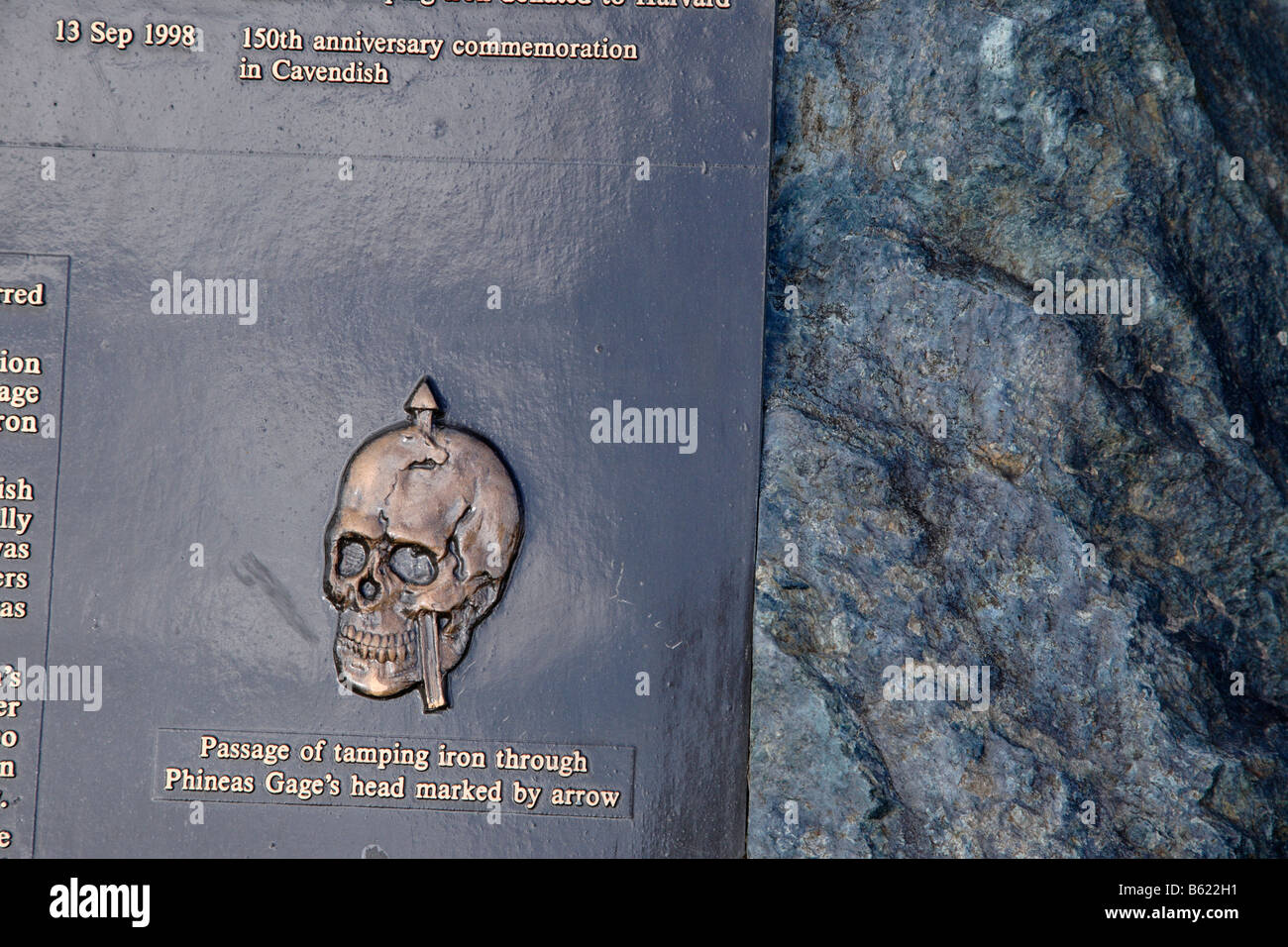 Phineas gage Banque de photographies et d’images à haute résolution Alamy