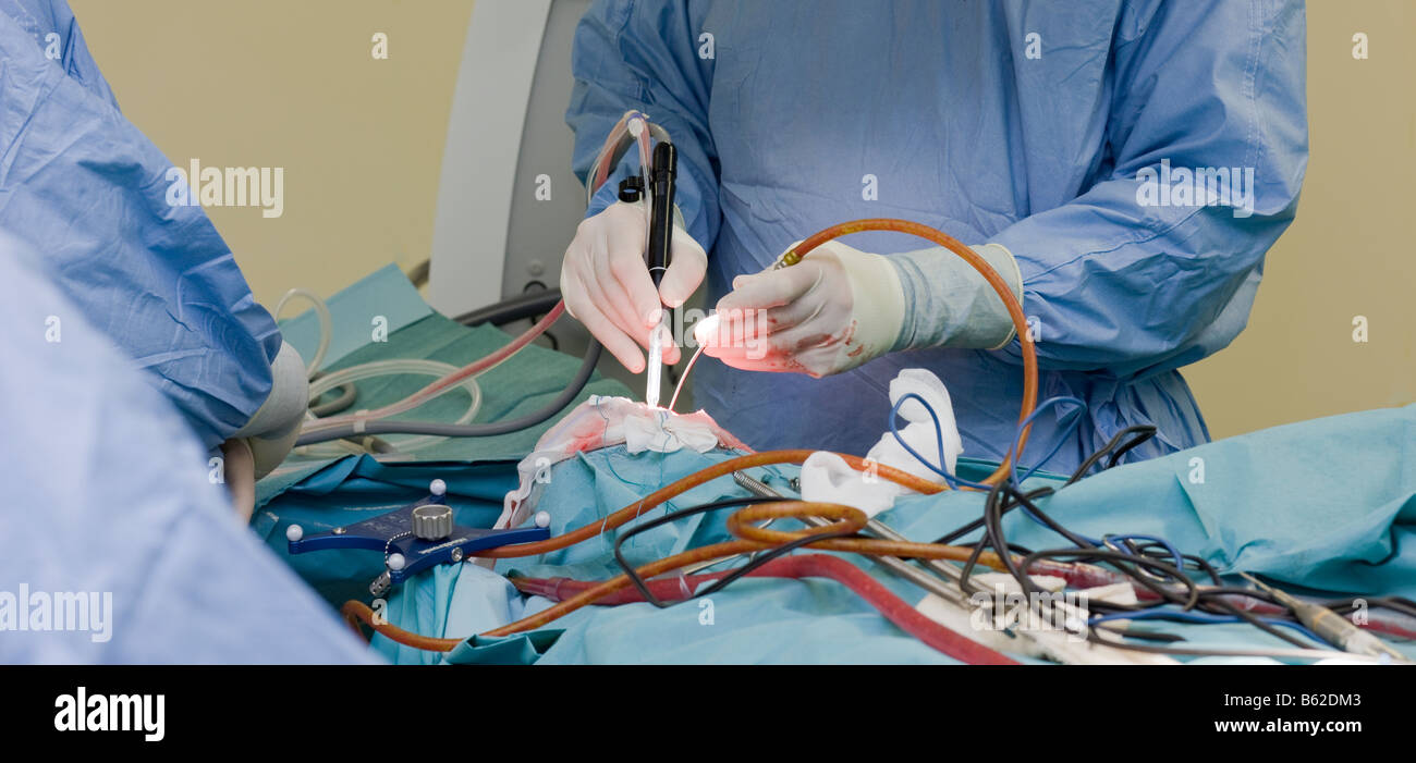 Les neurochirurgiens de retirer une tumeur bénigne au cerveau, Reykjavik, Islande Banque D'Images