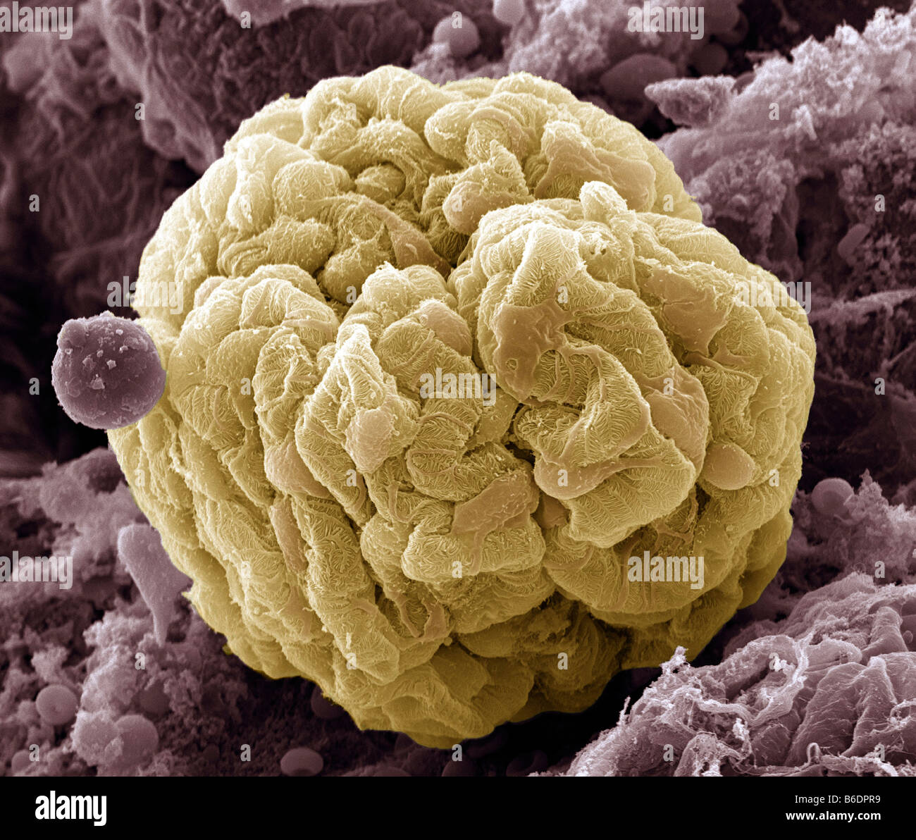 Glomérule du rein, couleur de l'analyse des électrons Microphotographie (SEM). Cellules Podocyte Banque D'Images