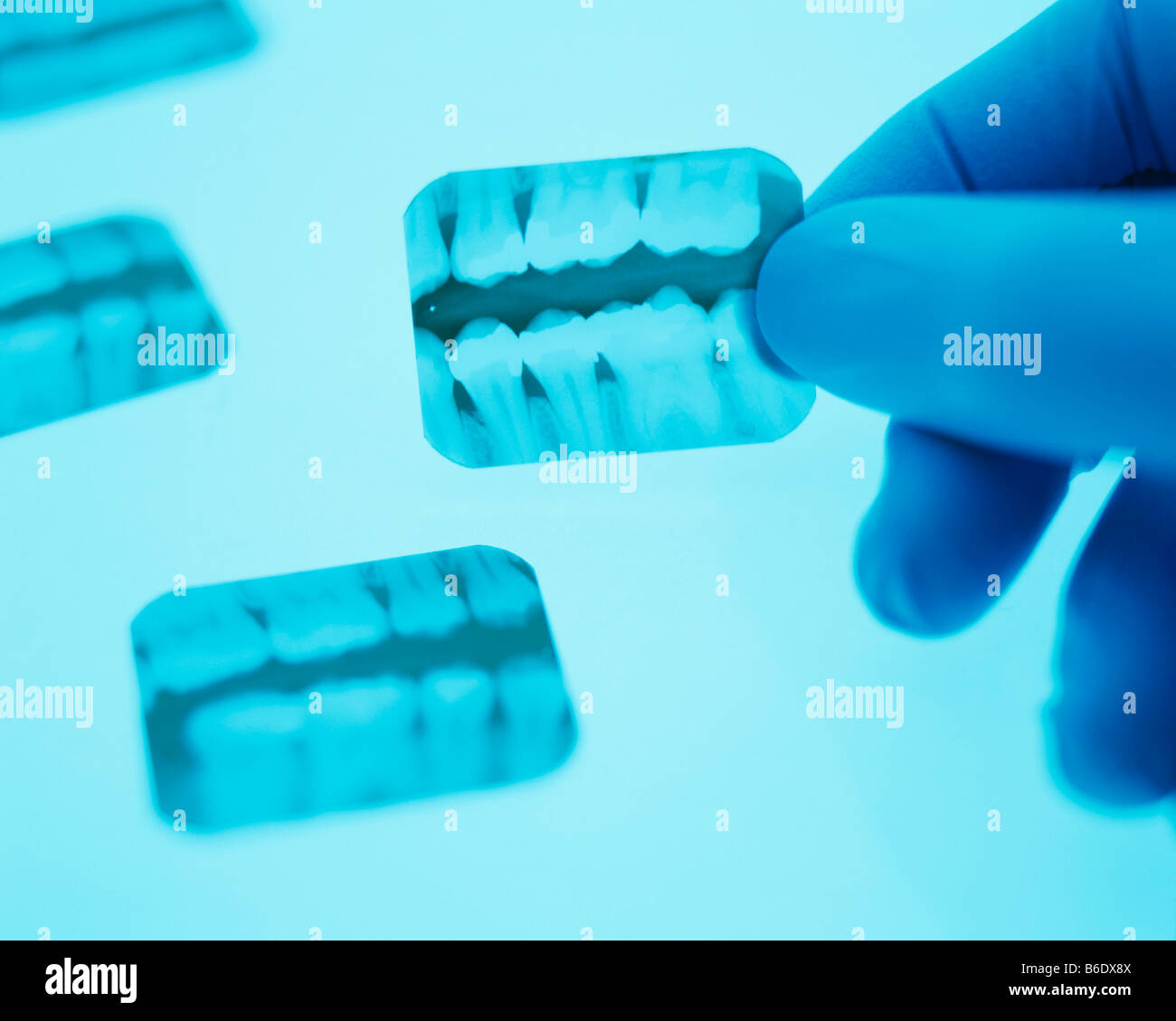 Les radiographies dentaires. Main tenant une radiographie dentaire.Cette montre les dents (blanc) à partir de la mâchoire supérieure et inférieure. Banque D'Images