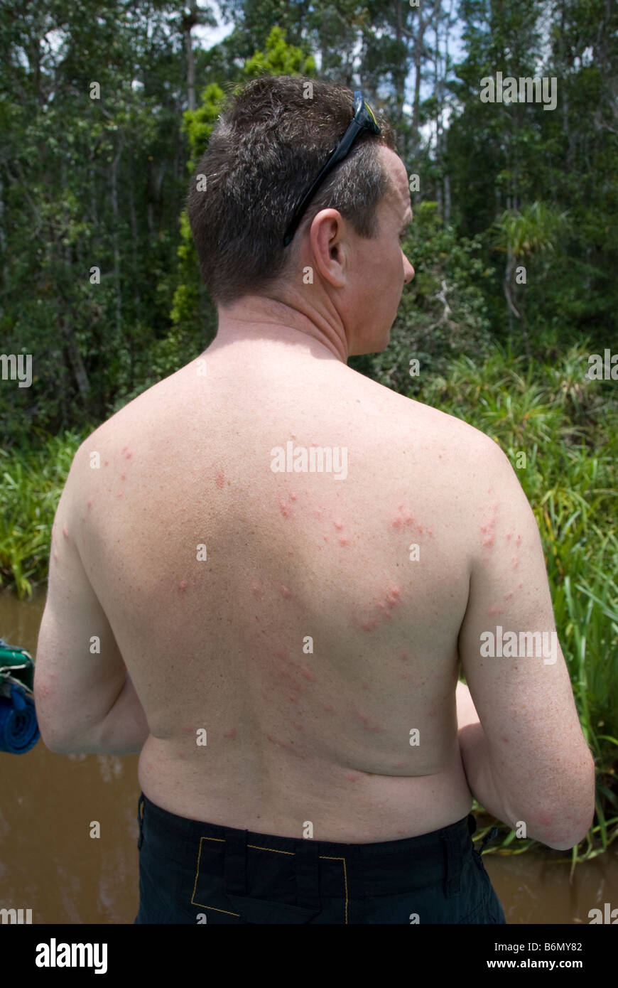 Homme avec les piqûres de moustiques sur le dos près d'une rivière à Bornéo Banque D'Images
