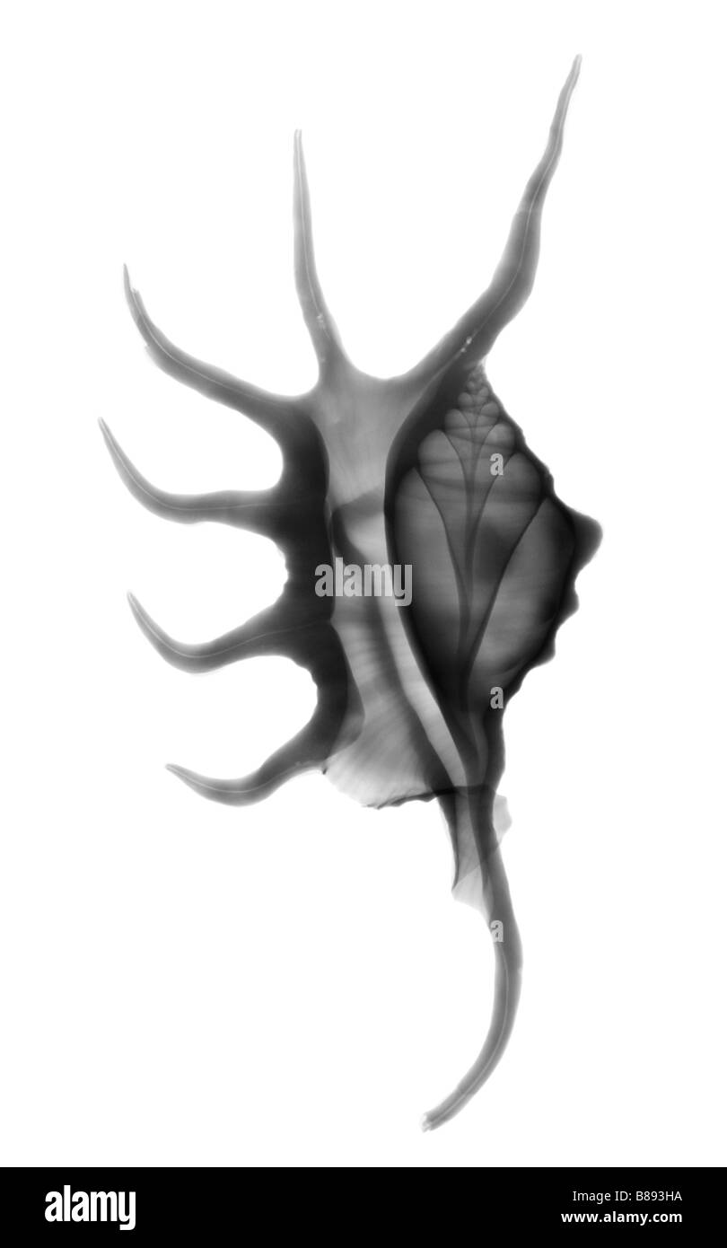 X ray d'une araignée Lambis Lambis shell sp Banque D'Images