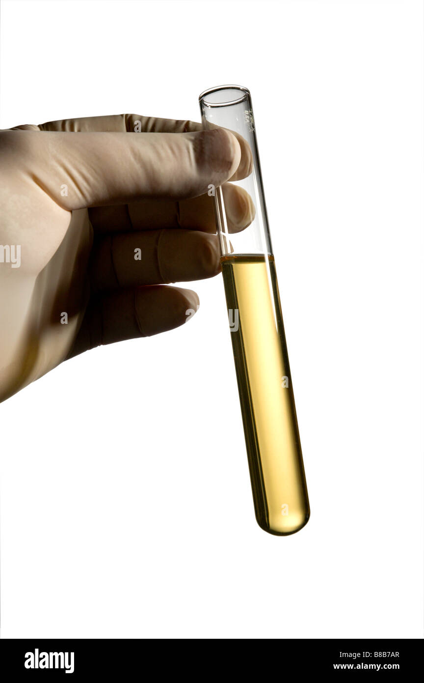 La main avec gant en latex détient test tube Banque D'Images