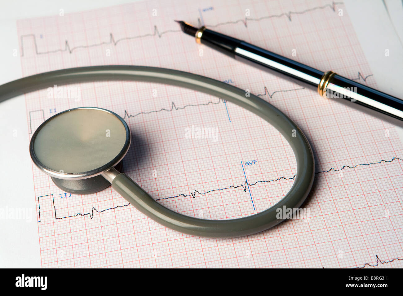 Un stéthoscope et un stylo sur un ecg Banque D'Images