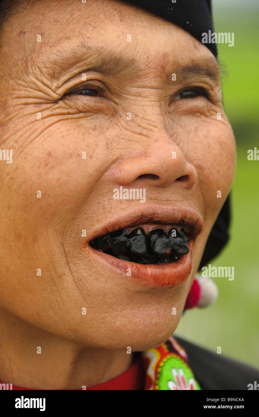 Les dents d'un noir Lu noir femme hilltribe à Tam Duong Vietnam Banque D'Images