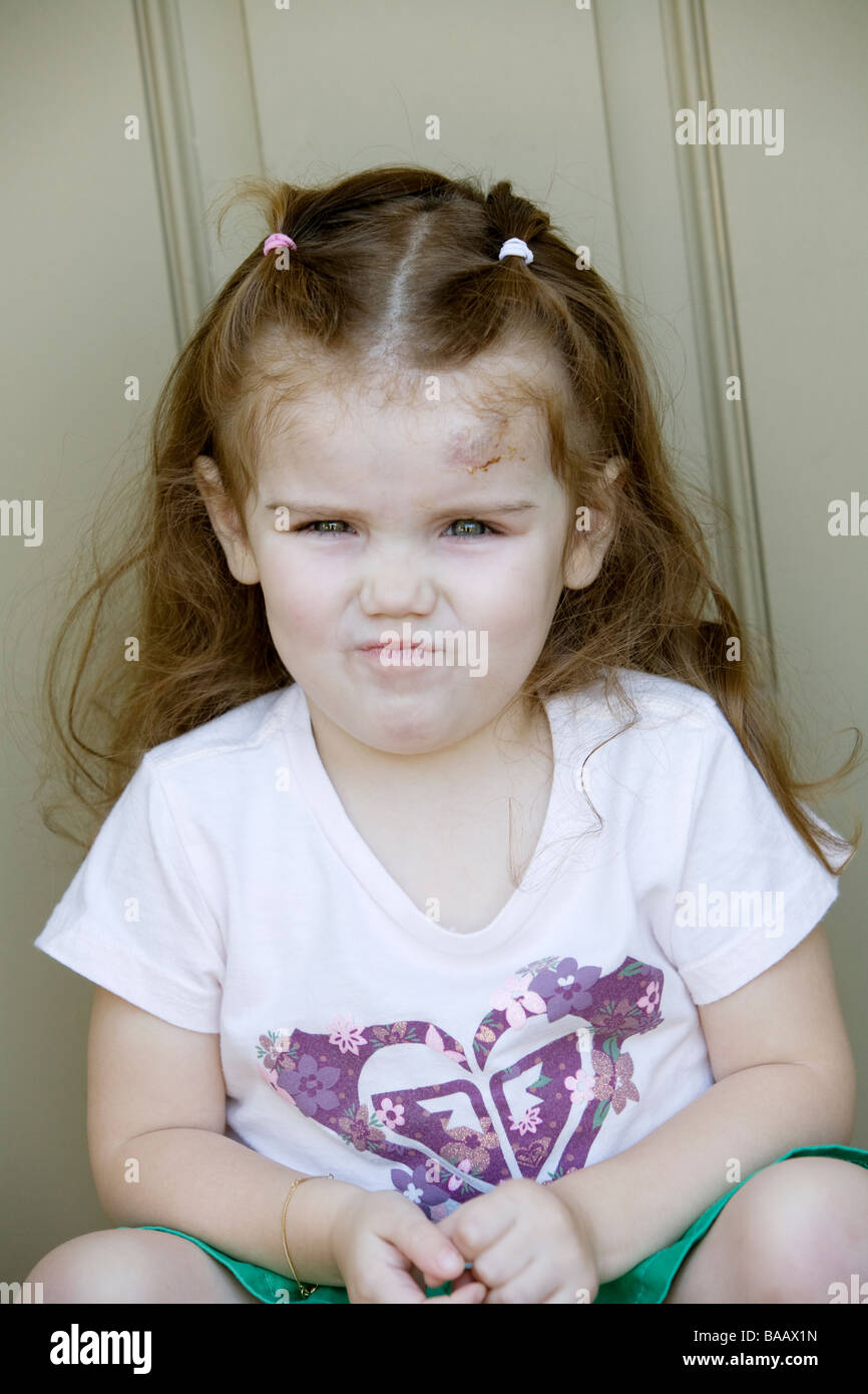 Une fille scandinave avec une blessure dans son front, USA. Banque D'Images