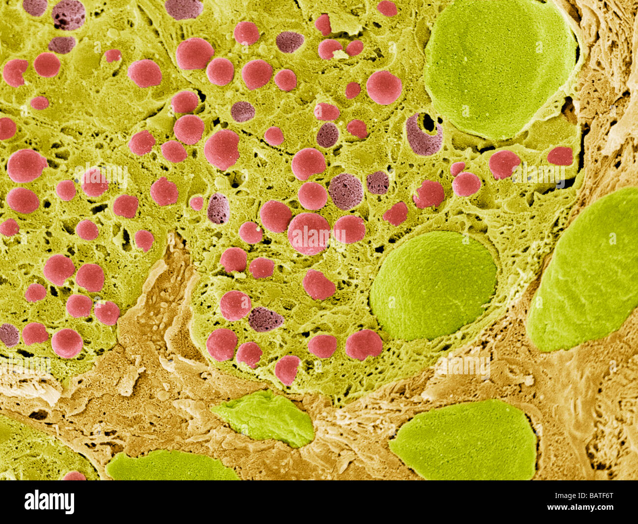 Des tissus du pancréas. Couleur de l'analyse des electronmicrograph (SEM) de tissu pancréatique fracturée Banque D'Images