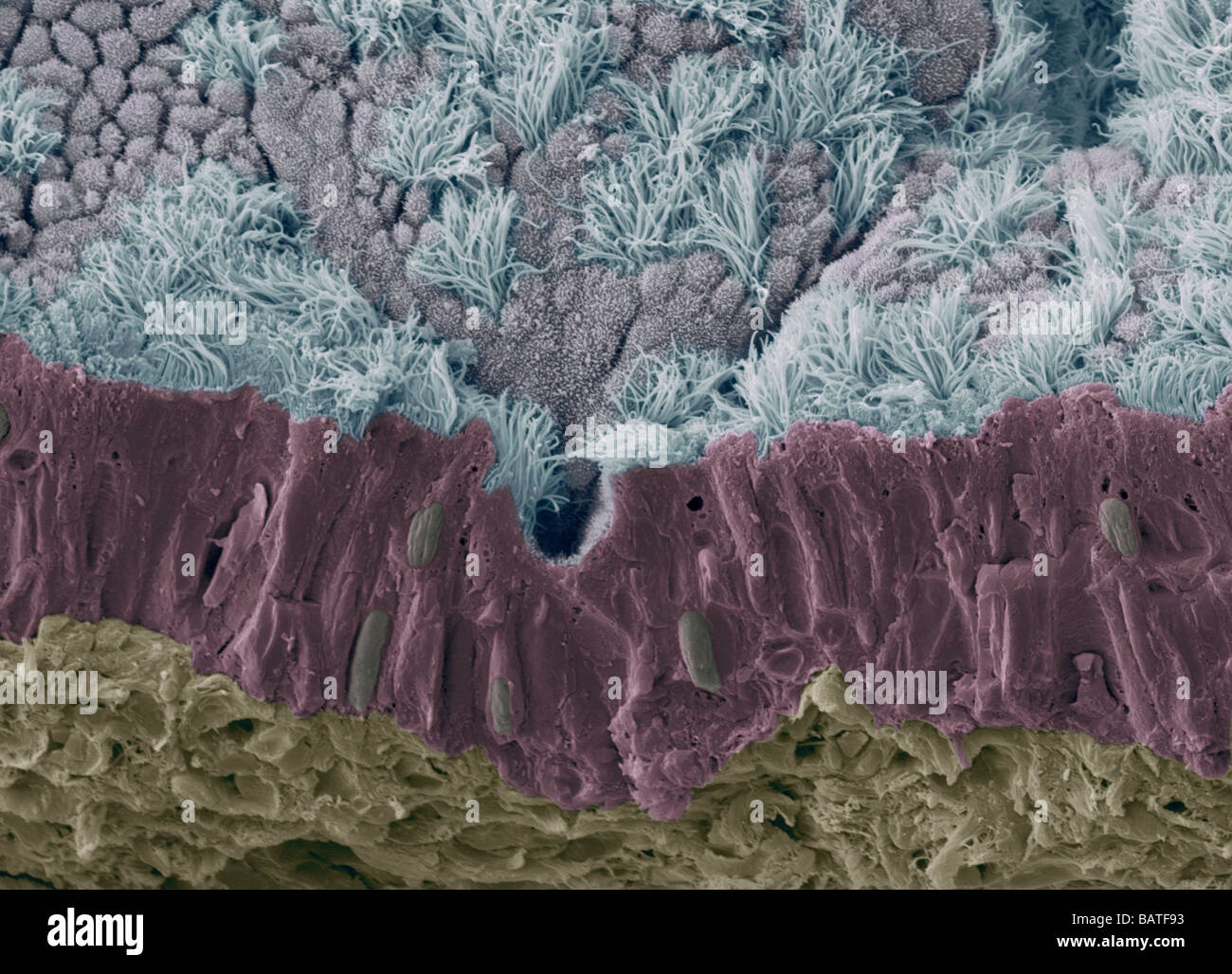 La muqueuse de la trachée. Scanningelectron colorées Microphotographie (SEM) d'une fracture de l'mucousmembrane de la trachée (vent pipe) Banque D'Images