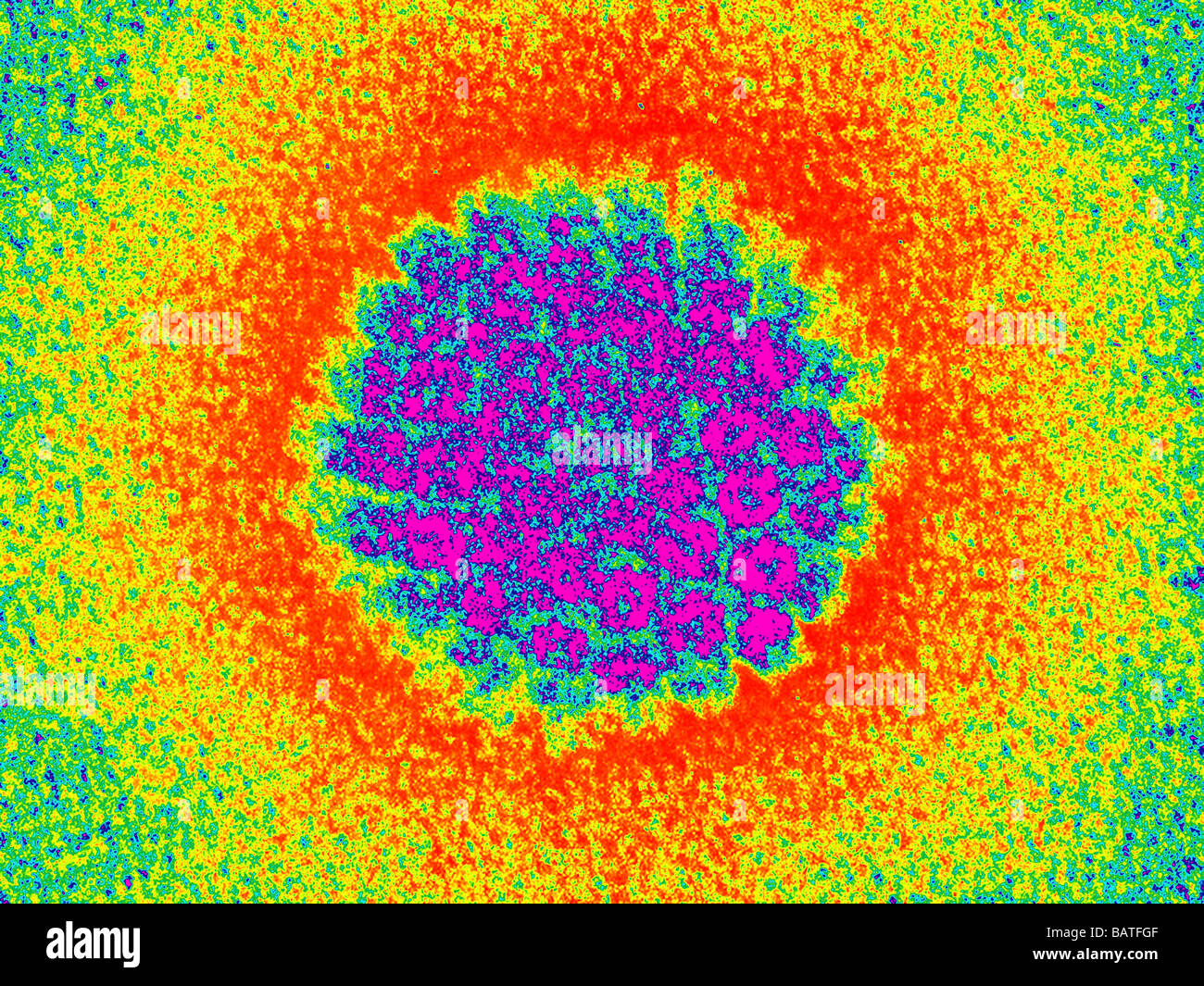Virus du papillome humain viral hpv Banque de photographies et d’images