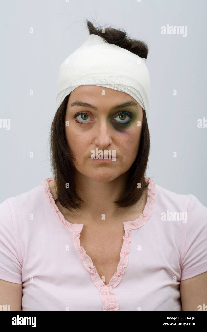 Une femme avec un œil noir et tête bandée Banque D'Images