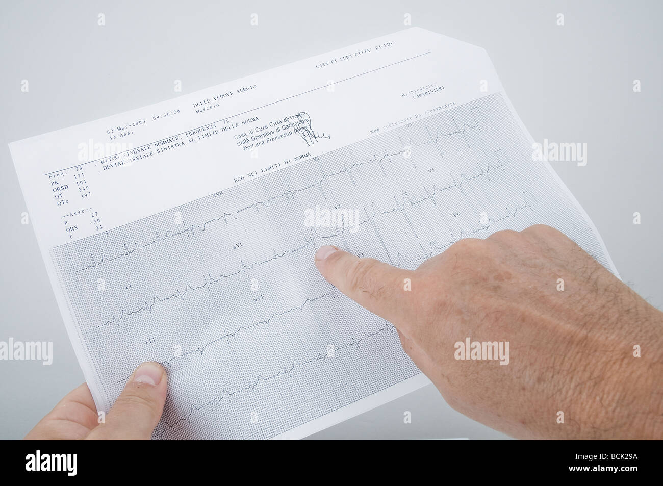 Le contrôle de l'électrocardiogramme trace Banque D'Images