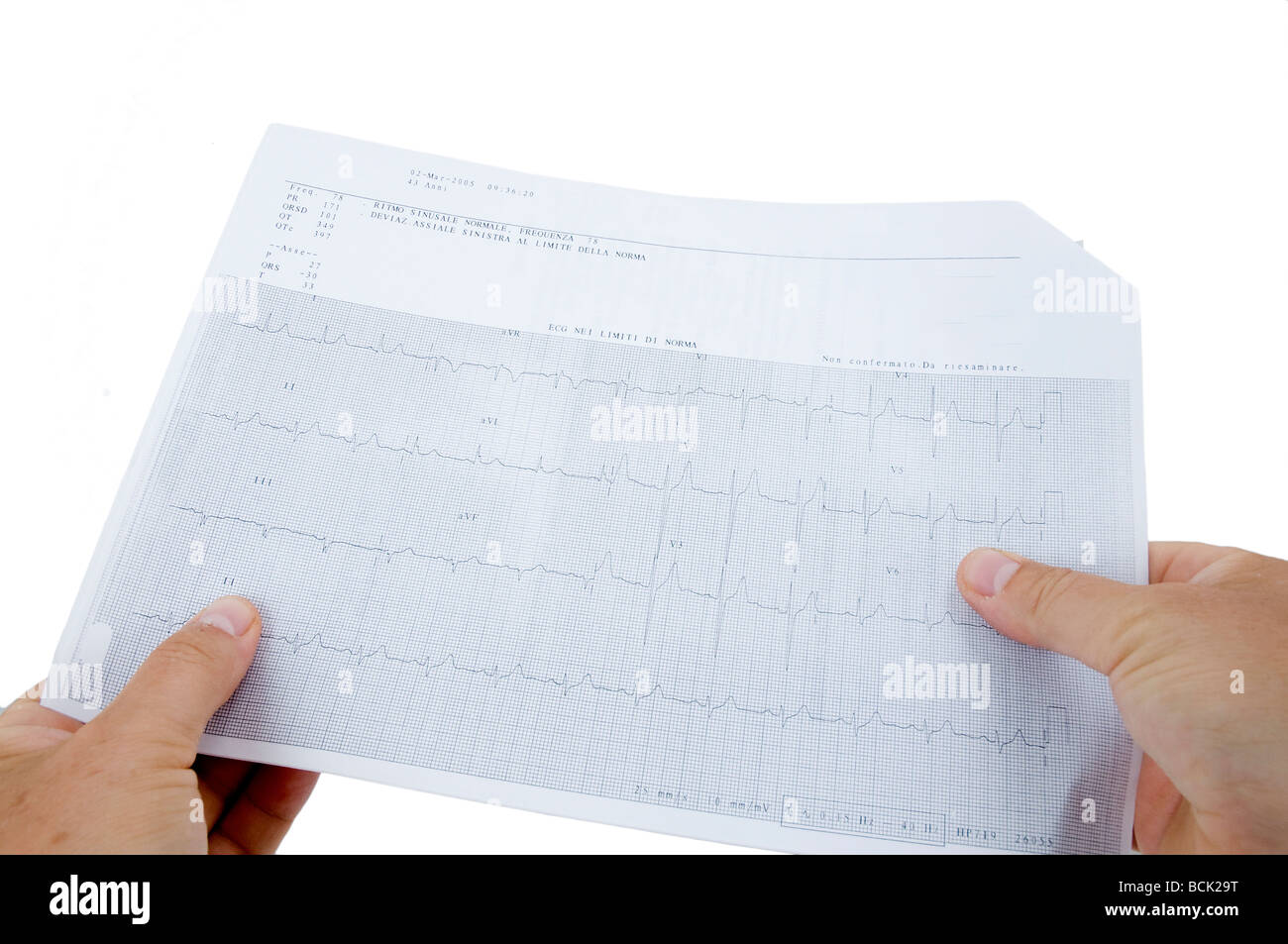 Le contrôle de l'électrocardiogramme trace Banque D'Images