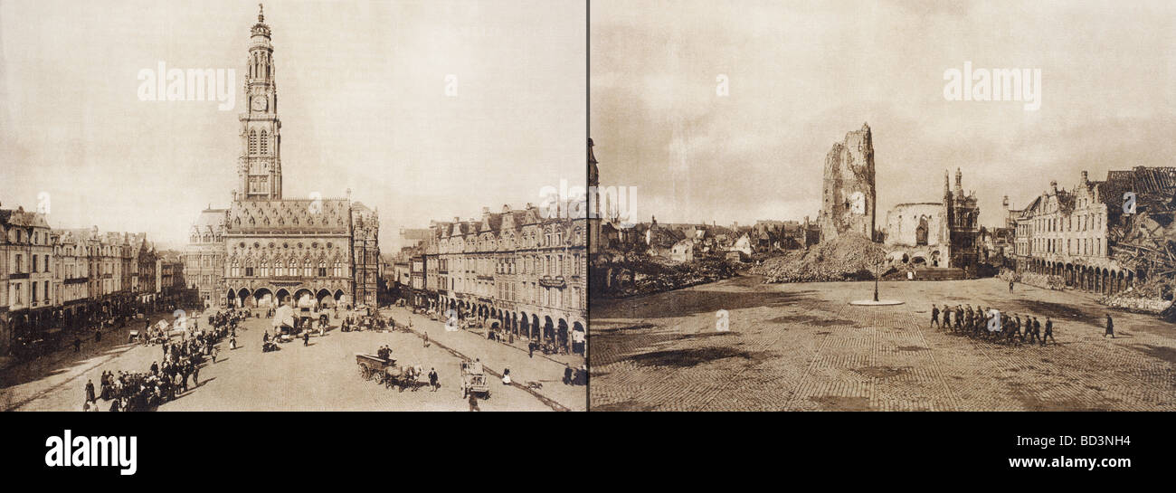 Après Arras Expansion to Regional Hospitals