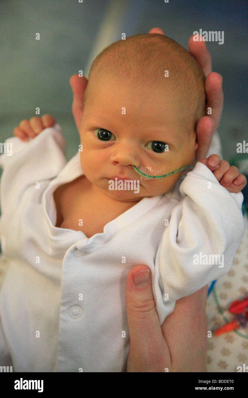 Jour 5 Un Vieux Bebe Ne Premature A 31 Semaines Pesant 1kg Le Bebe Souffre Avec Syndrome De Detresse Respiratoire Et D Une Jaunisse Photo Stock Alamy