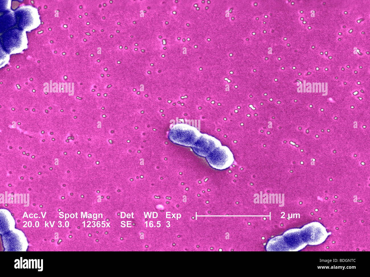 Bactérie acinetobacter Banque de photographies et d’images à haute ...