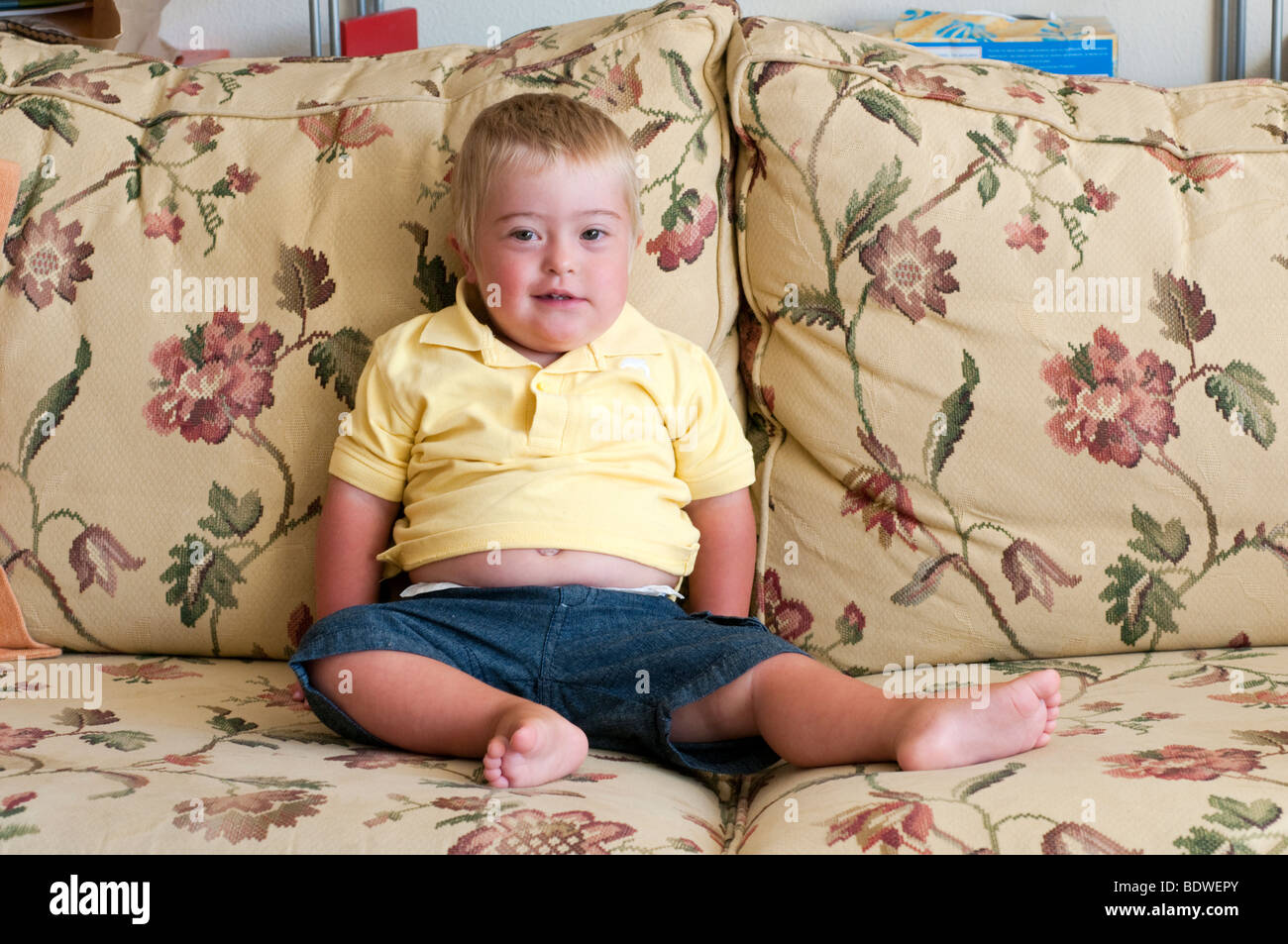 Iago est un garçon de 2 ans avec le syndrome de Banque D'Images