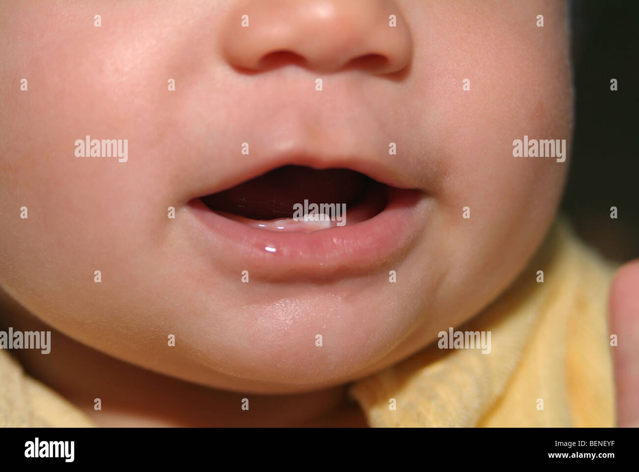 Les Dents De Bebe Faisant Saillie Au Dessus Des Gencives Photo Stock Alamy Les Dents De Bebe Faisant Saillie Au Dessus Des Gencives Photo Stock Alamy