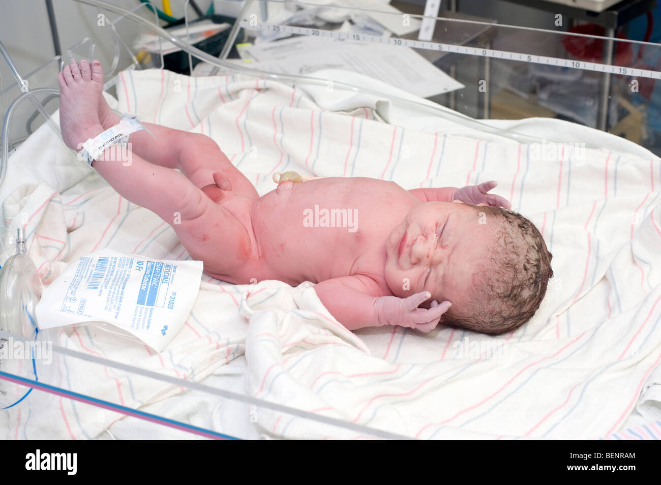 Boy nouveau-né immédiatement après la livraison par ceserean (c-section). Modèle bébé est libéré. Banque D'Images