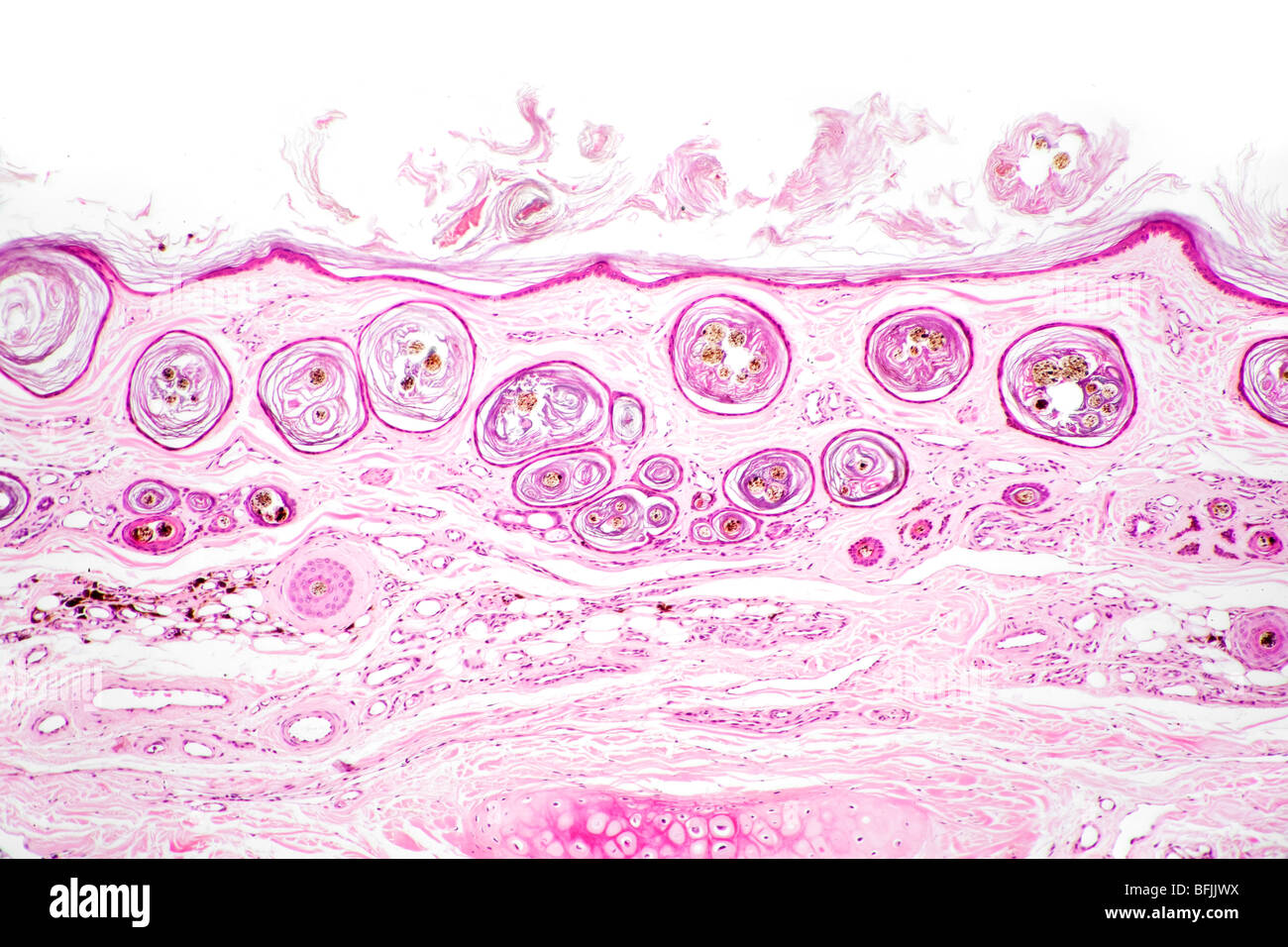 Vitrail en fond clair photomicrographie de follicules de cheveux dans la peau des mammifères (section vu du dessus) Banque D'Images