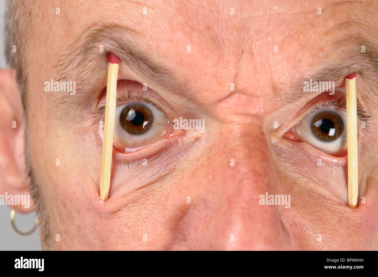 Close up de ugly man en gardant les yeux grands ouverts avec des allumettes  Photo Stock - Alamy