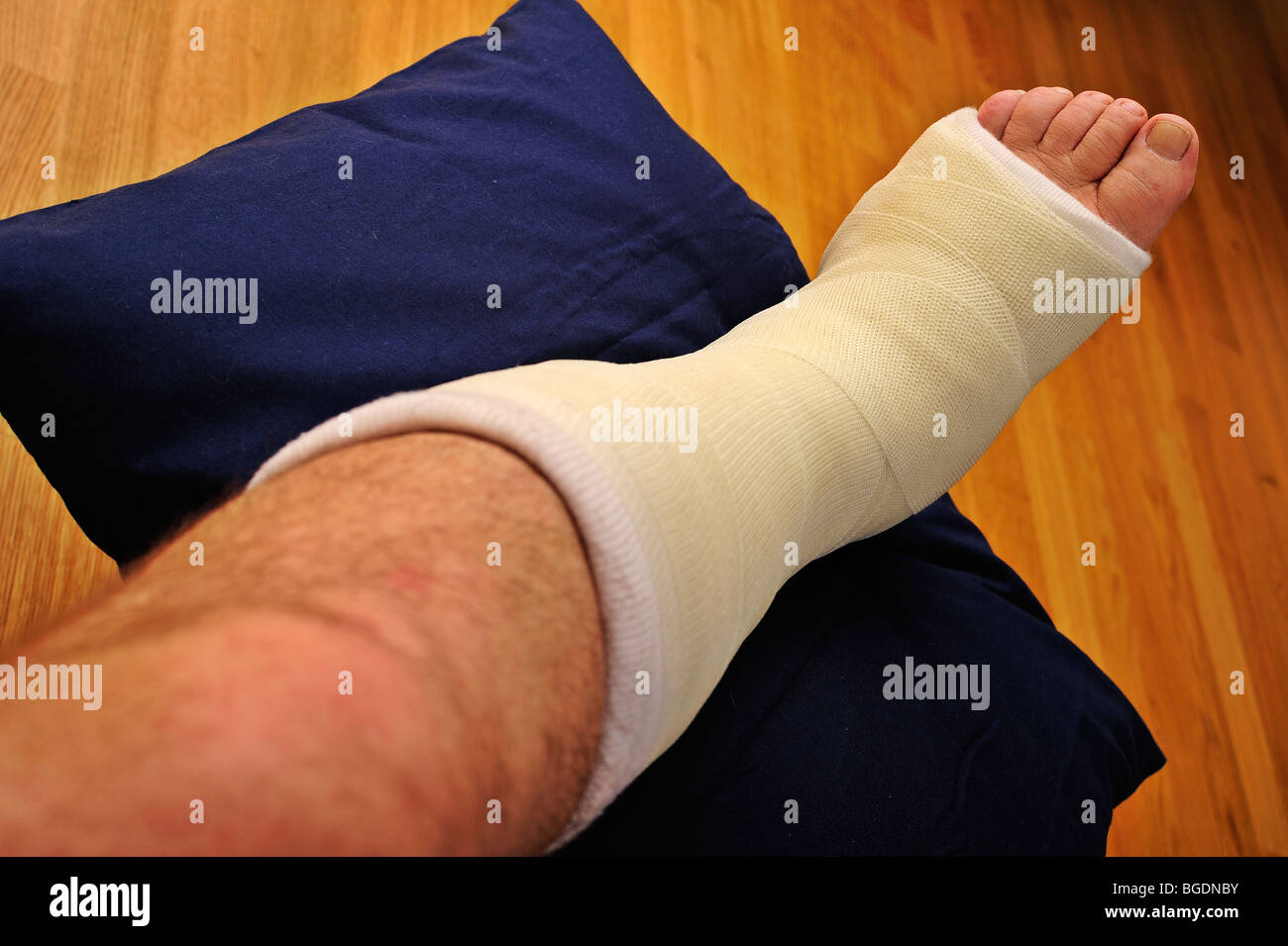 Détail d'une main d'homme jambe cassée dans un plâtre, élevée sur un coussin Banque D'Images
