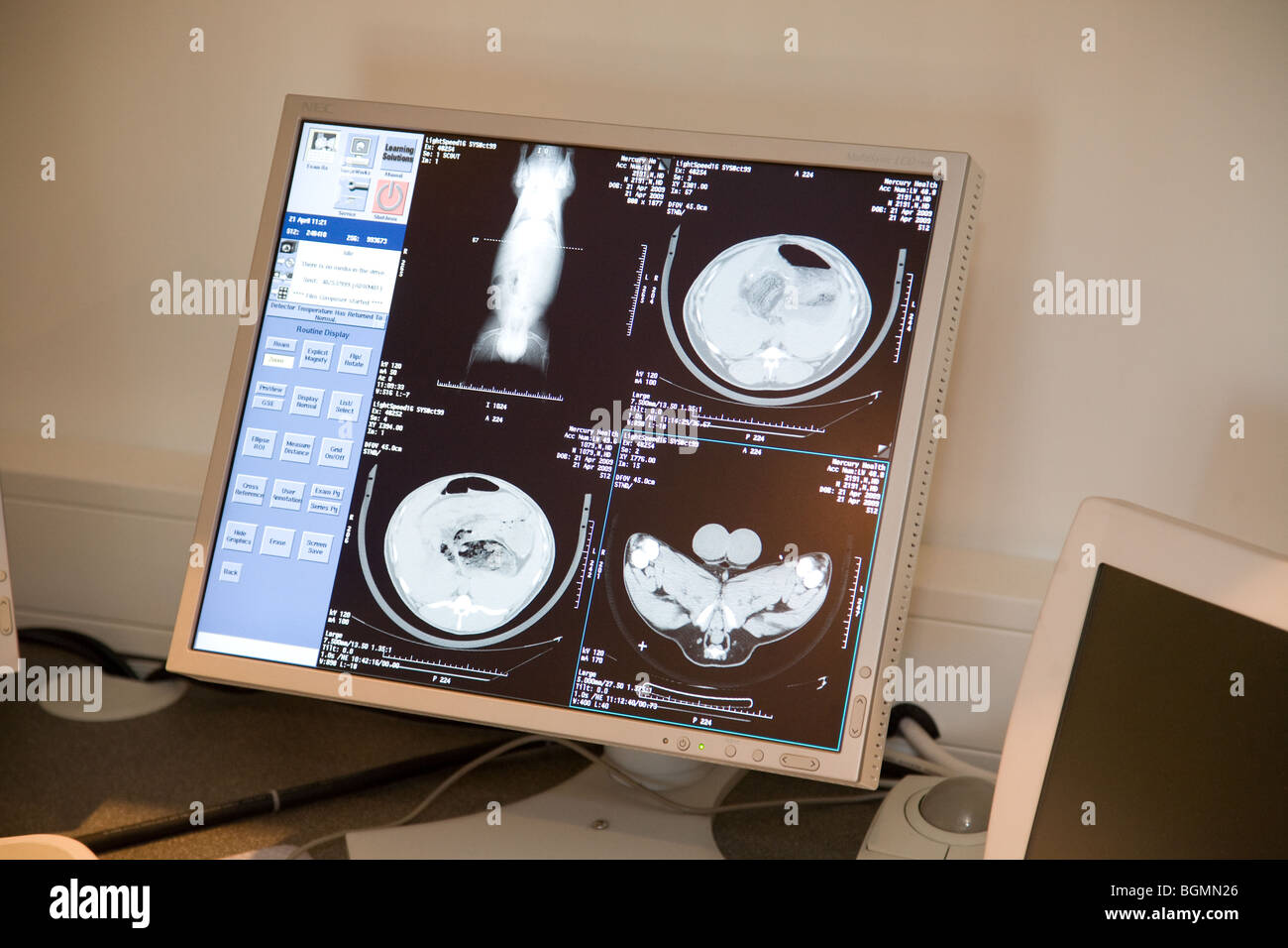 Un mouton dans un scanner IRM Banque D'Images