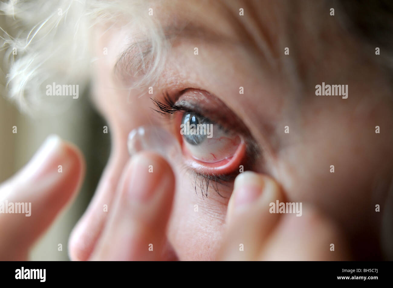 Young woman putting contact lense dans son œil Banque D'Images