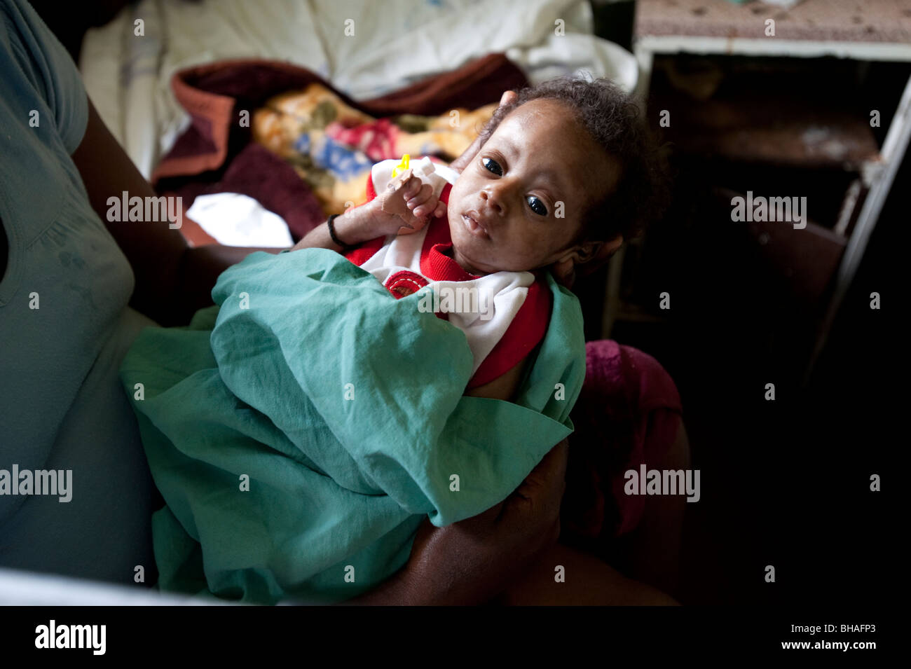 Bébé dans un état critique à l'hôpital d'afrique Banque D'Images