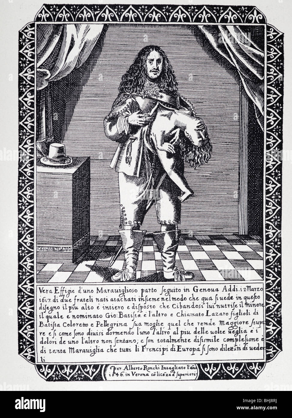 Jumeaux siamois Lazare et Joannes Baptista Colloredo Banque D'Images