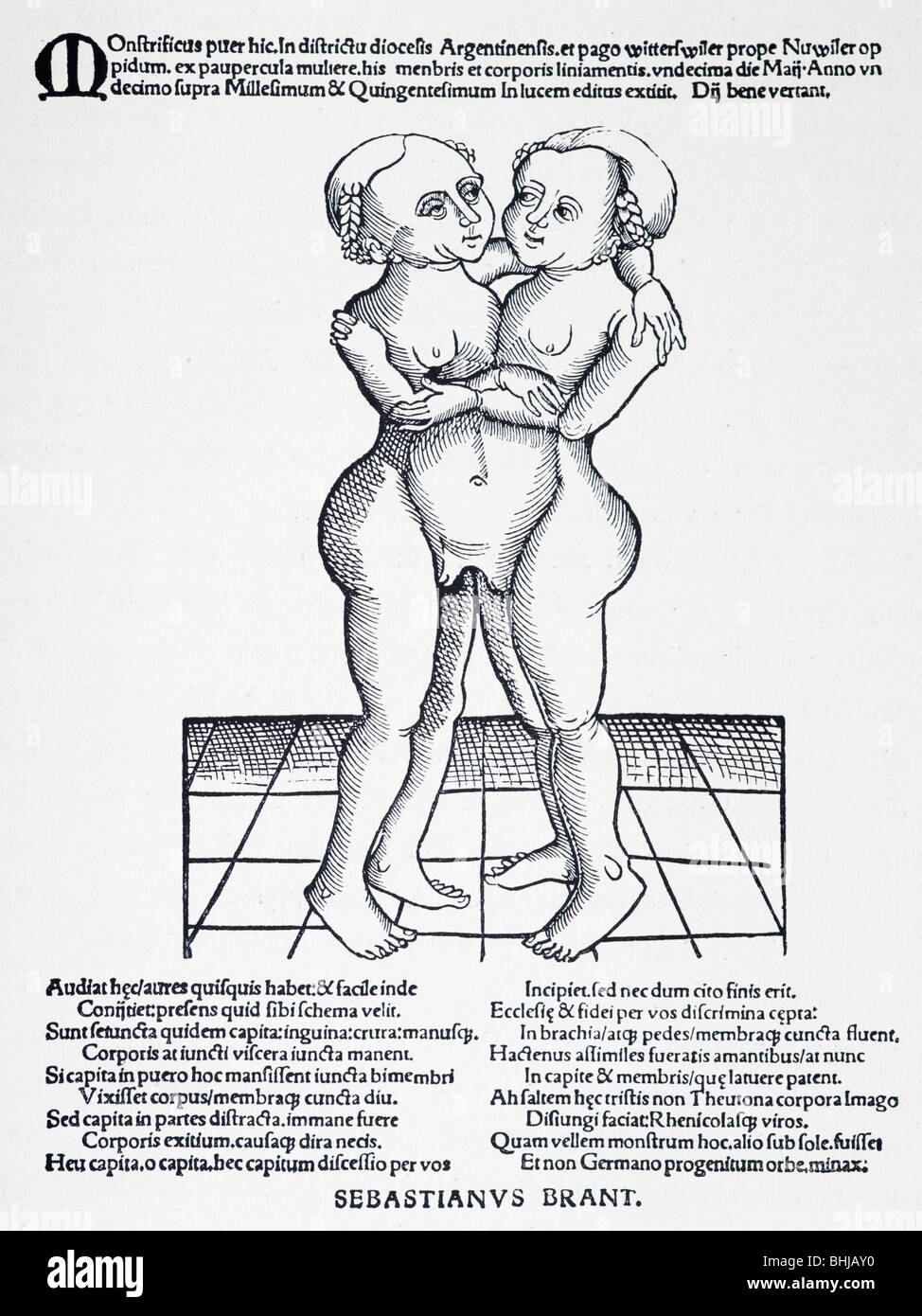 Jumeaux siamois né près de vers, 1495. Banque D'Images