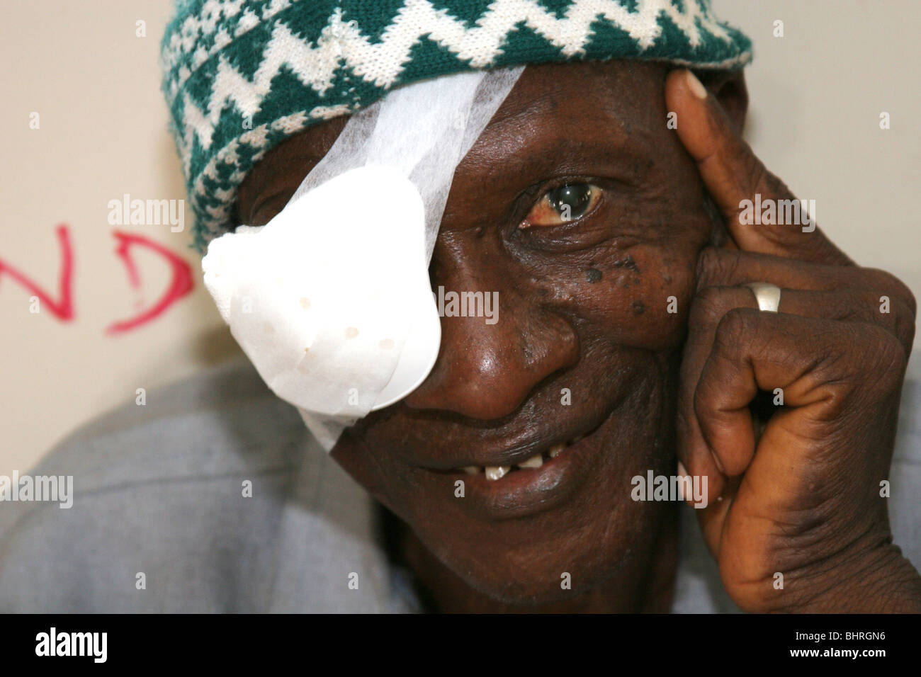 Un homme africain avec un pansement sur un oeil après une opération de la  cataracte, la Sierra Leone, l'Afrique Photo Stock - Alamy