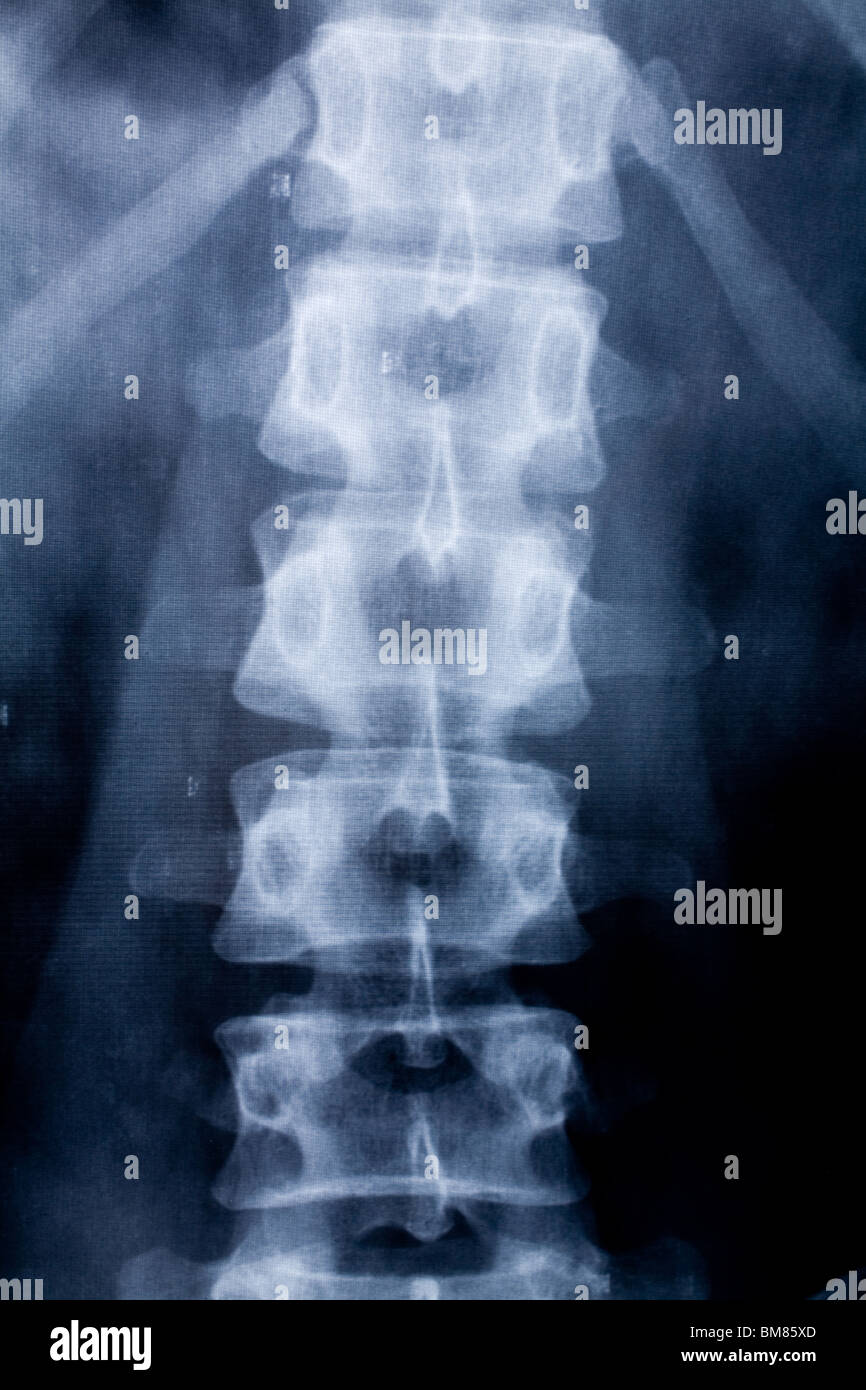 X-ray du corps pour le fond photo Banque D'Images