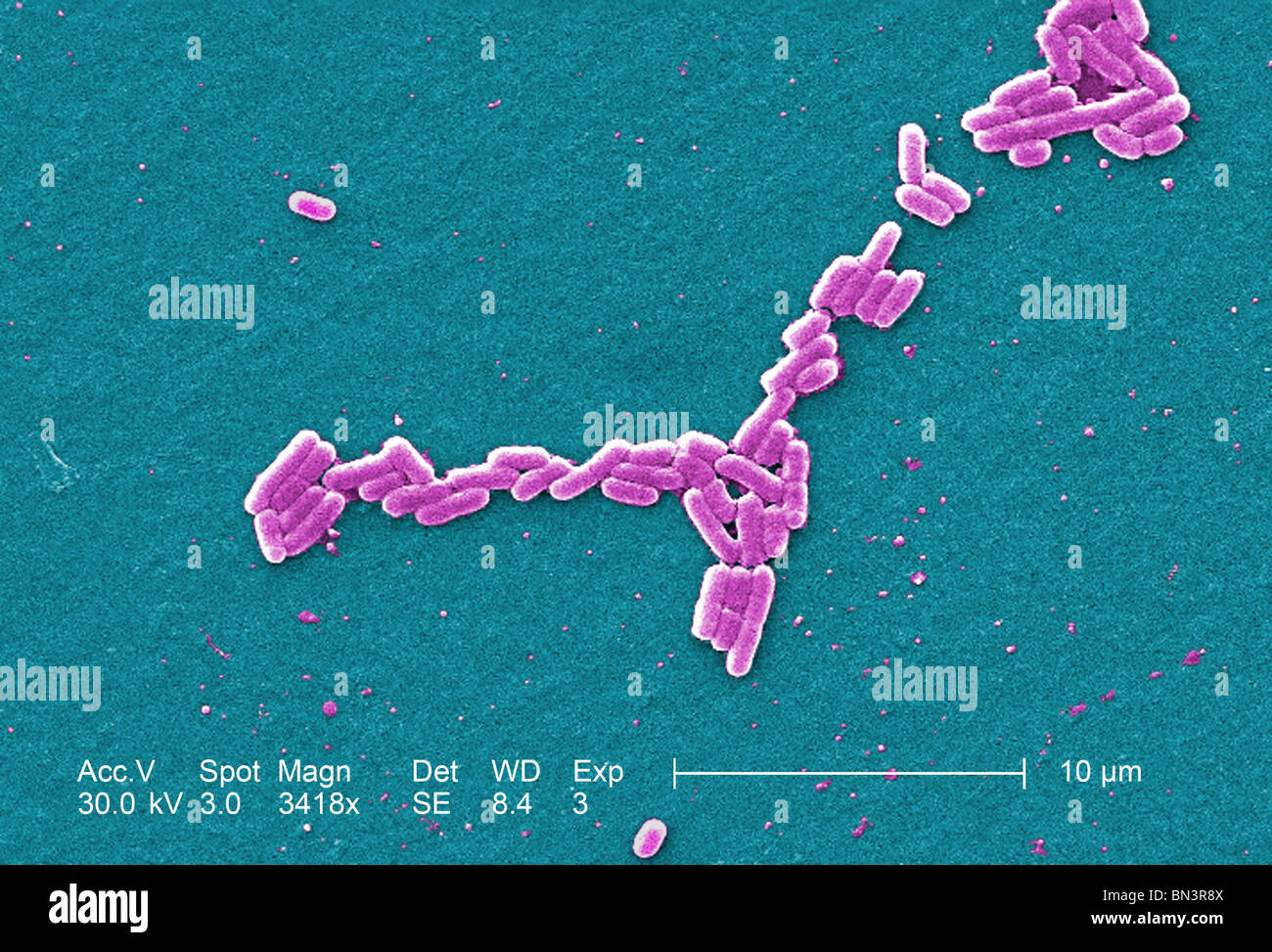 L'analyse des électrons Microphotographie colorisée d'Escherichia coli O157:H7 à un grossissement de 3418x Banque D'Images