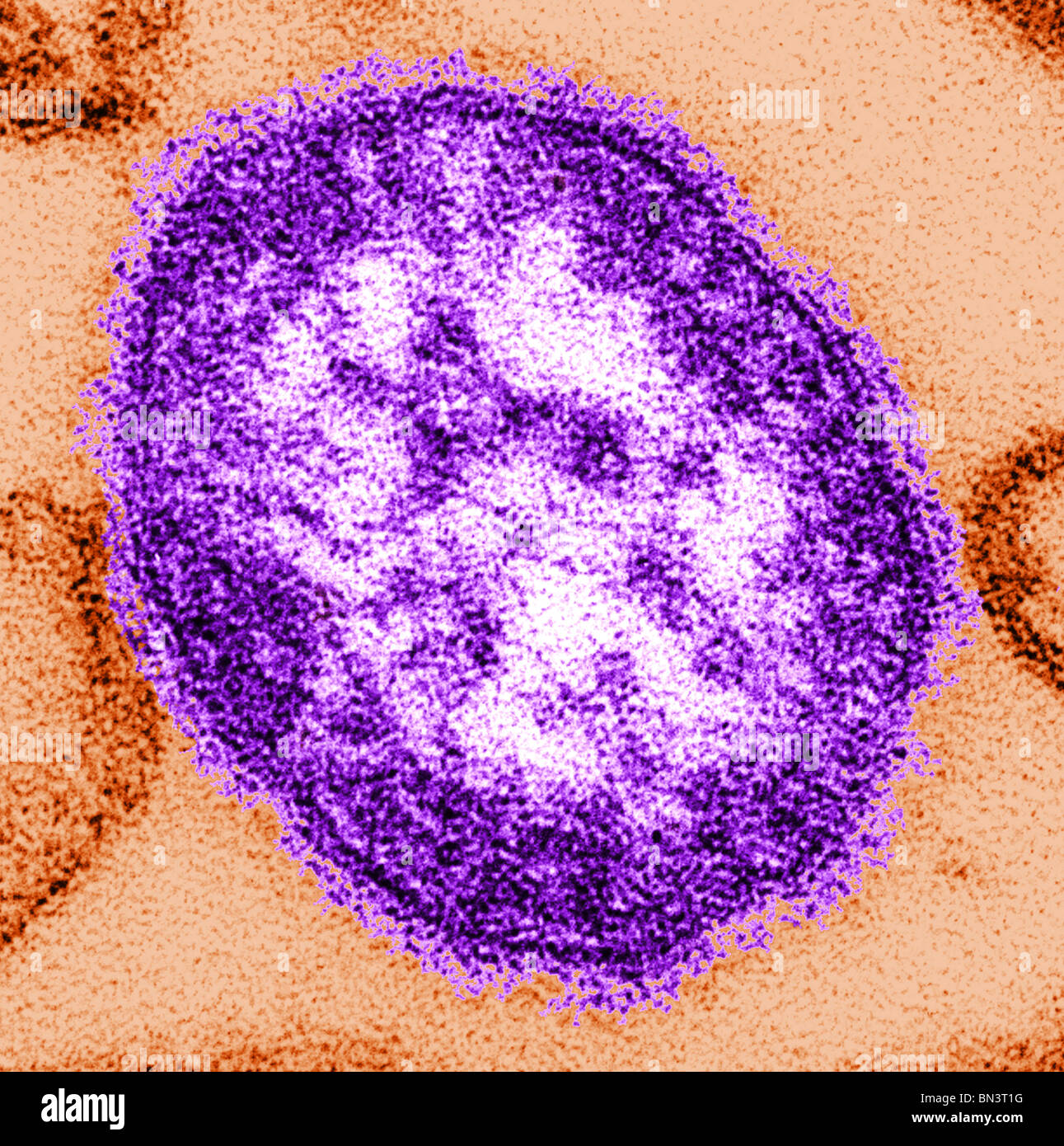 Section mince micrographie électronique à transmission (TEM) d'une seule particule virale, ou "virino", du virus de la rougeole Banque D'Images