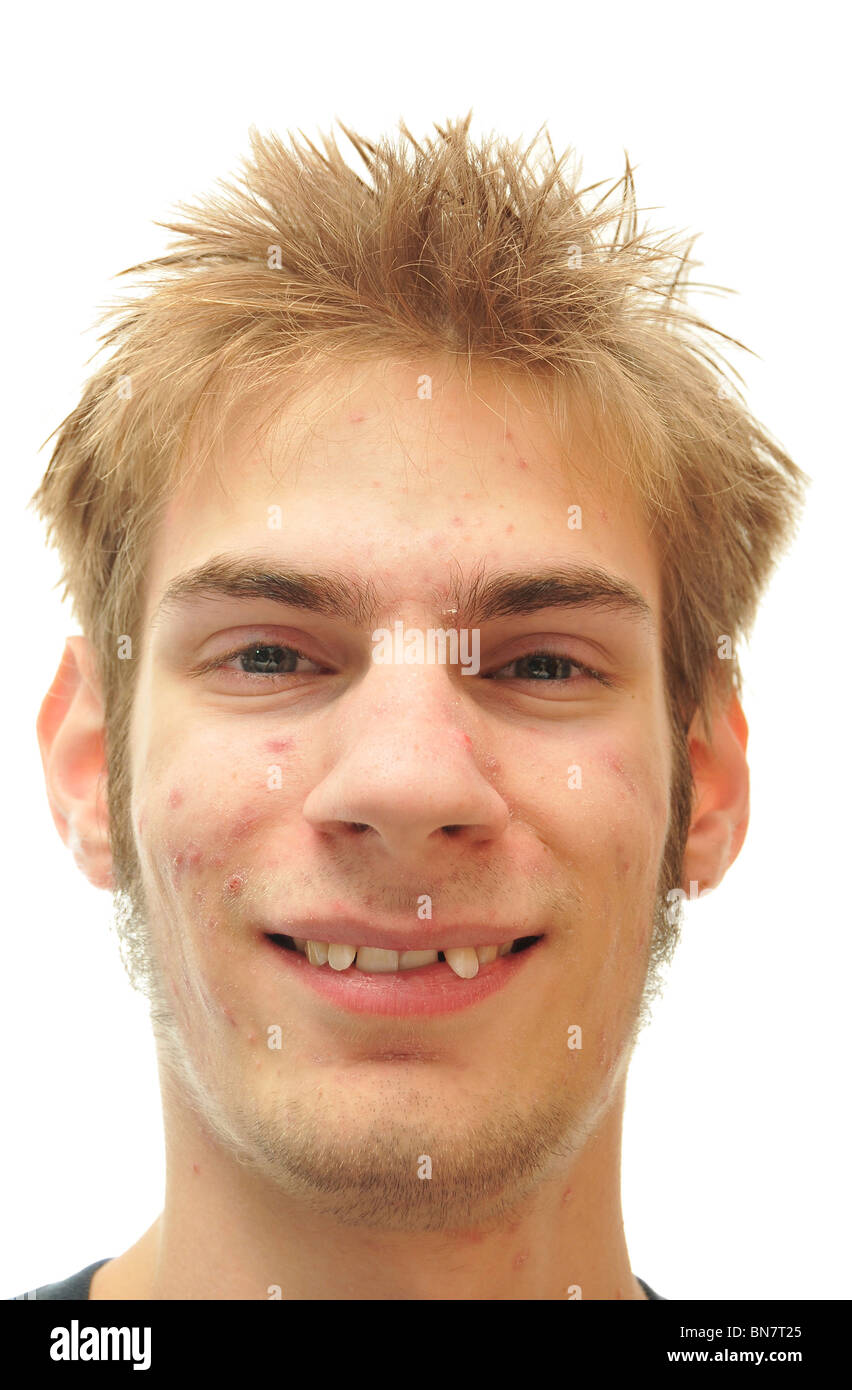 Homme essayant de sourire avec des dents de travers isolated on white Banque D'Images