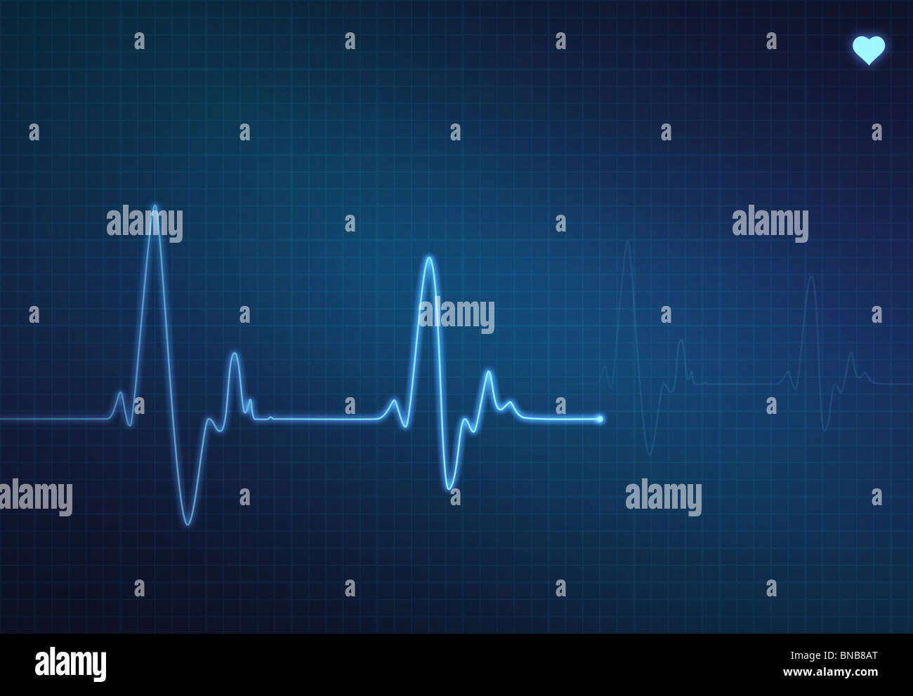 Moniteur de signaux médicaux (électrocardiogramme) avec fond bleu et le symbole du coeur Banque D'Images
