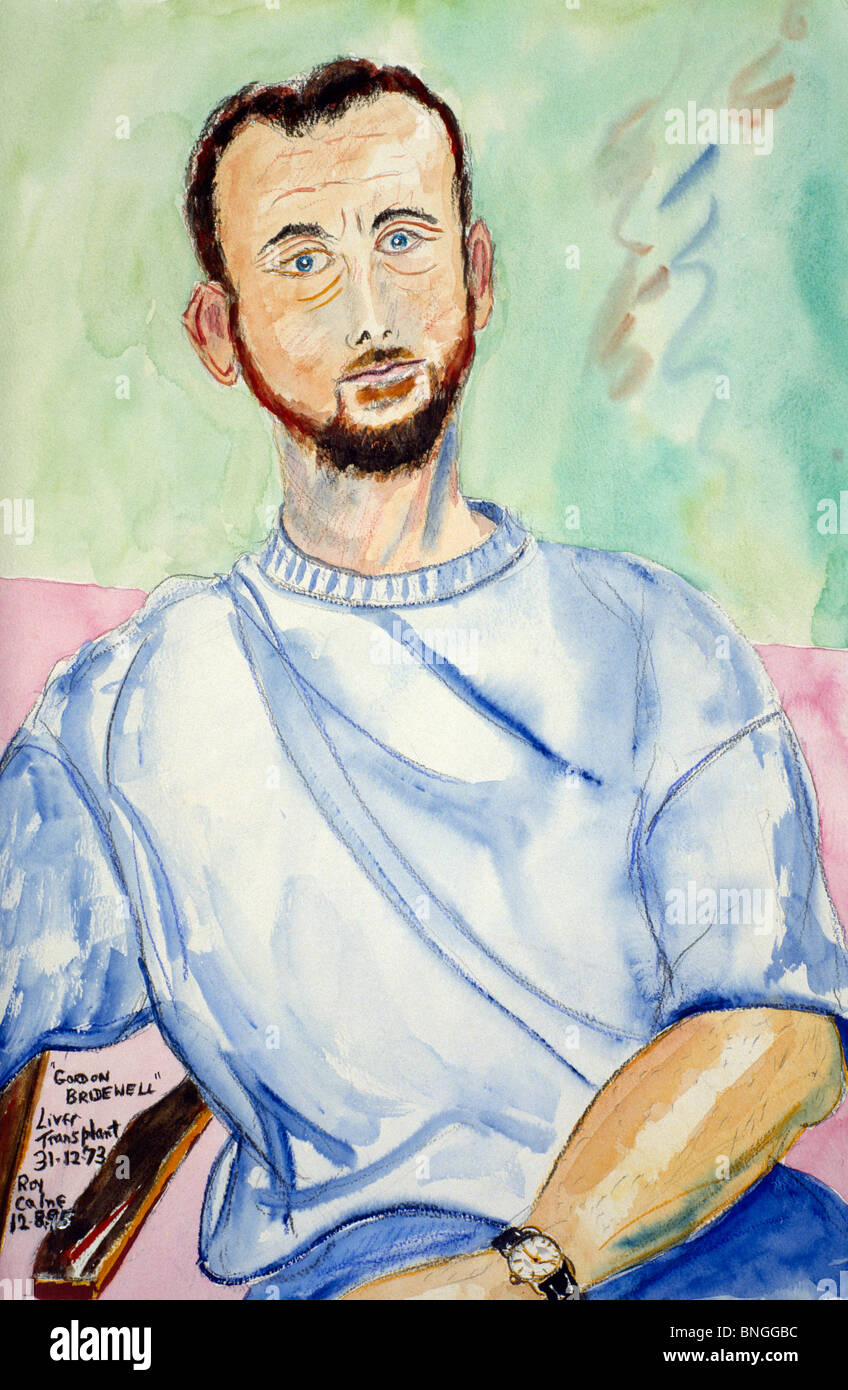 Gordon Bridewell, la plus longue en Europe greffé du survivant, 22 ans par Sir Roy Calne Banque D'Images