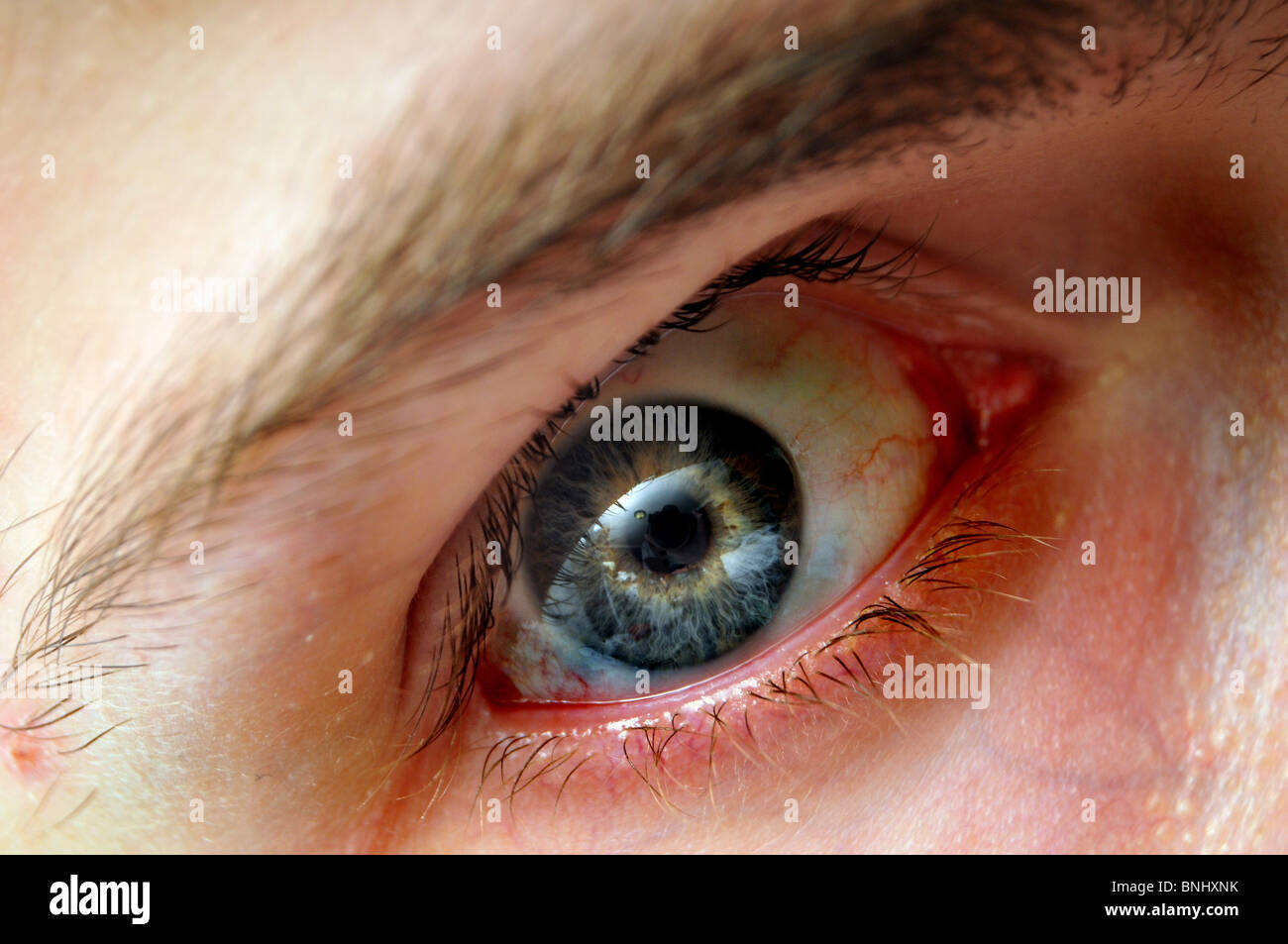 Gros plan de race blanche intense blanc bleu vert jaune du globe oculaire iris avec les vaisseaux sanguins et viens. Banque D'Images