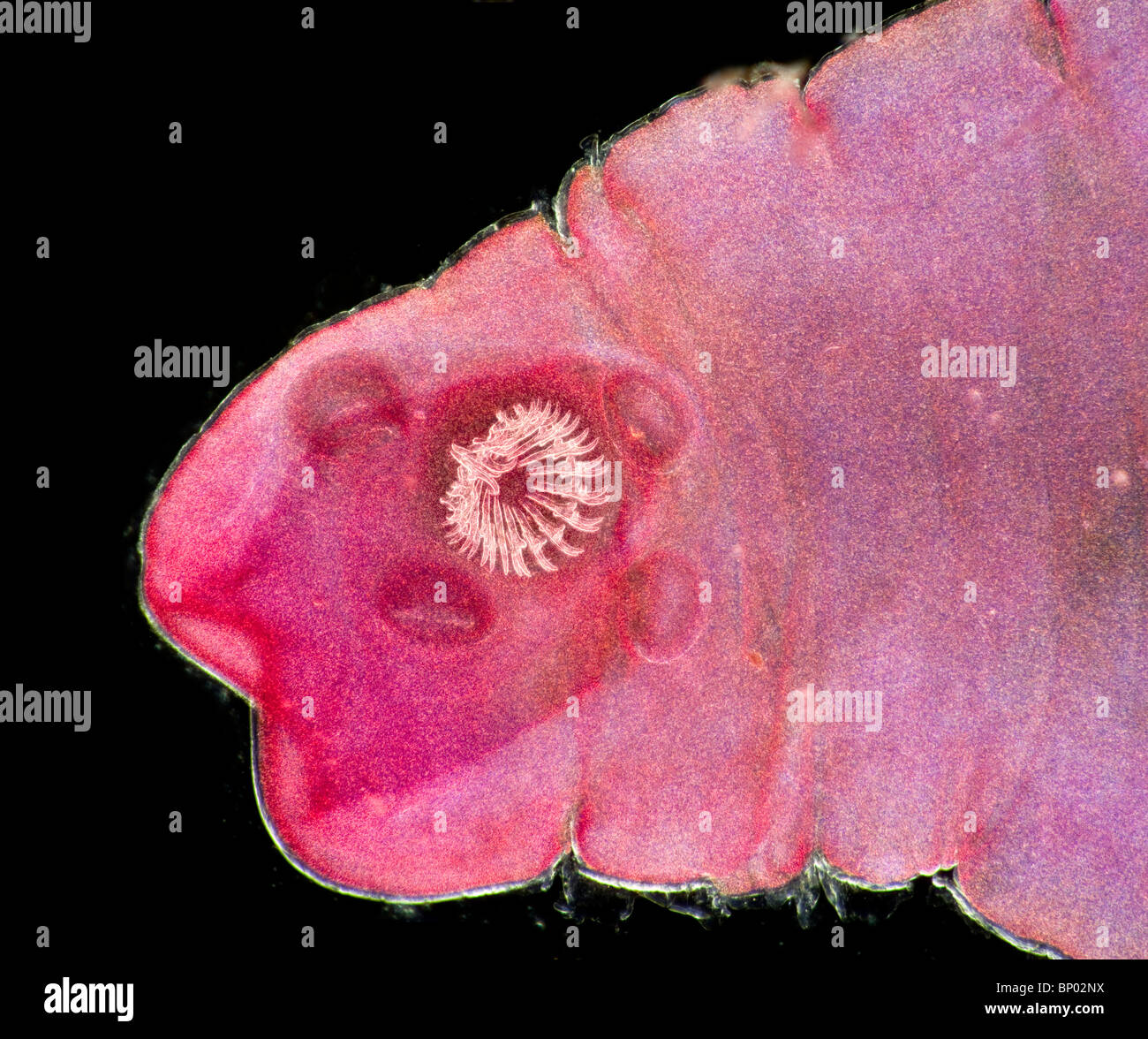 Cysticercus pisiformis Darkfield photomicrographie, lapin en tissu, la larve d'un ver solitaire, Taenia Banque D'Images