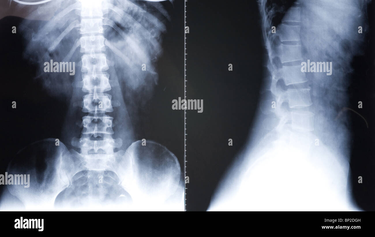 X-ray du corps pour le fond photo Banque D'Images