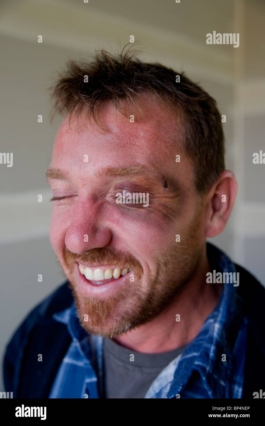 Homme avec oeil noir Banque D'Images