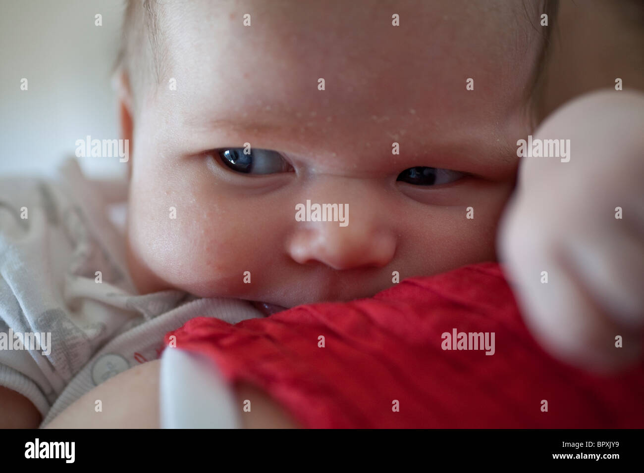 2 Mois Fille Bebe Avec La Peau Seche Sur Le Visage Photo Stock Alamy