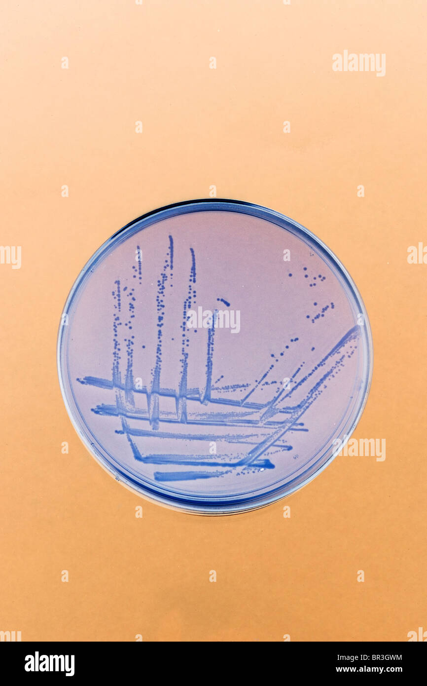 Des stries et des bactéries se développe sur une plaque de gélose dans le laboratoire Banque D'Images
