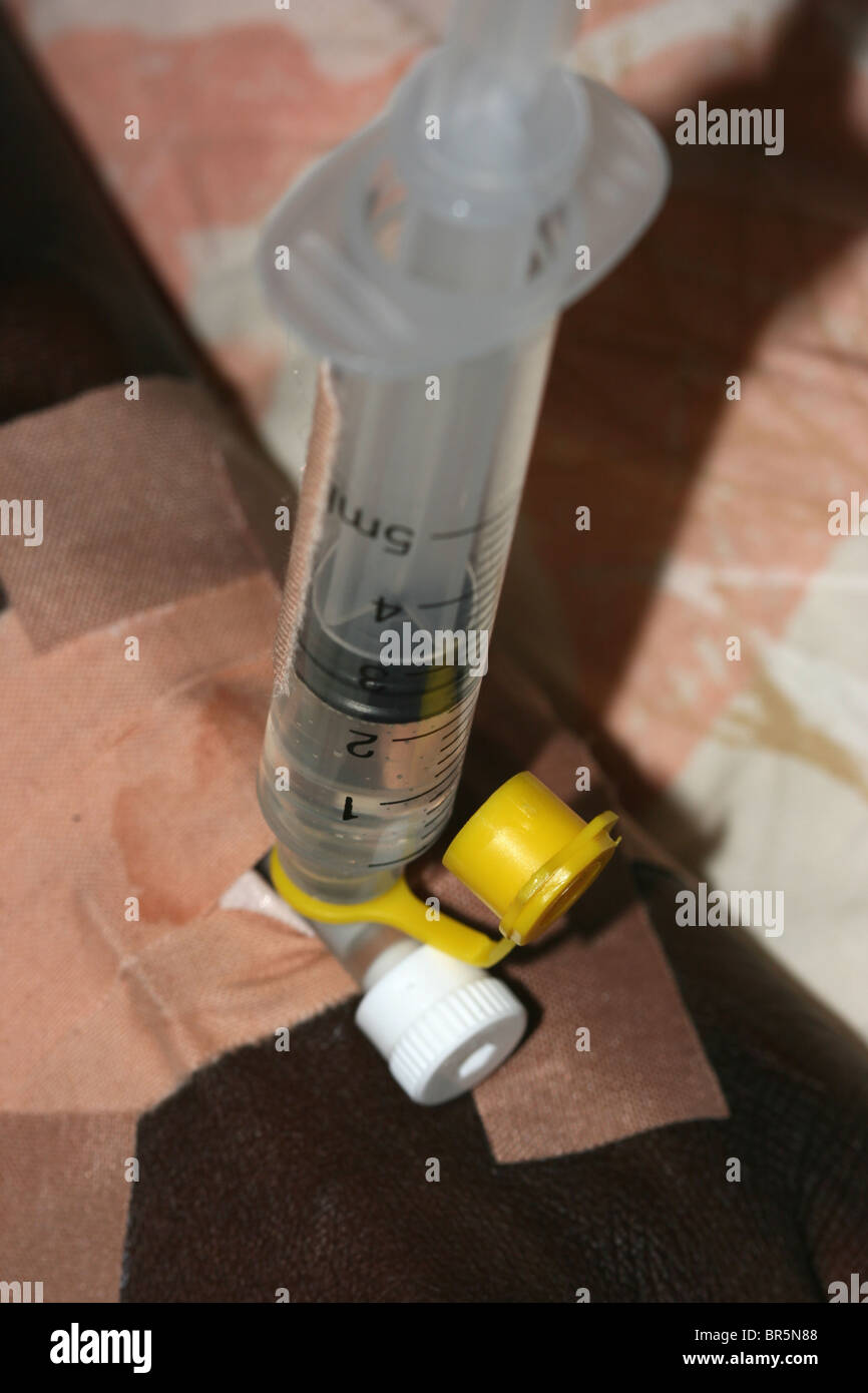 Une seringue attachée à la canule d'une main de femme pour perfusion de médecine Banque D'Images