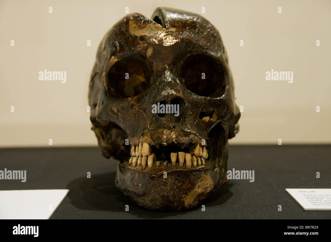 Le crâne de Mary Ann Higgins une femme de 19 ans qui a été pendu en Grande-Bretagne sur l'affichage à l'Herbert Gallery and Museum Banque D'Images