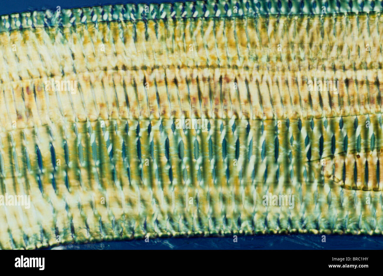 La lumière Microphotographie (LM) d'une section longitudinale montrant les vaisseaux scalariformes de fougère, grossissement x1200 Banque D'Images